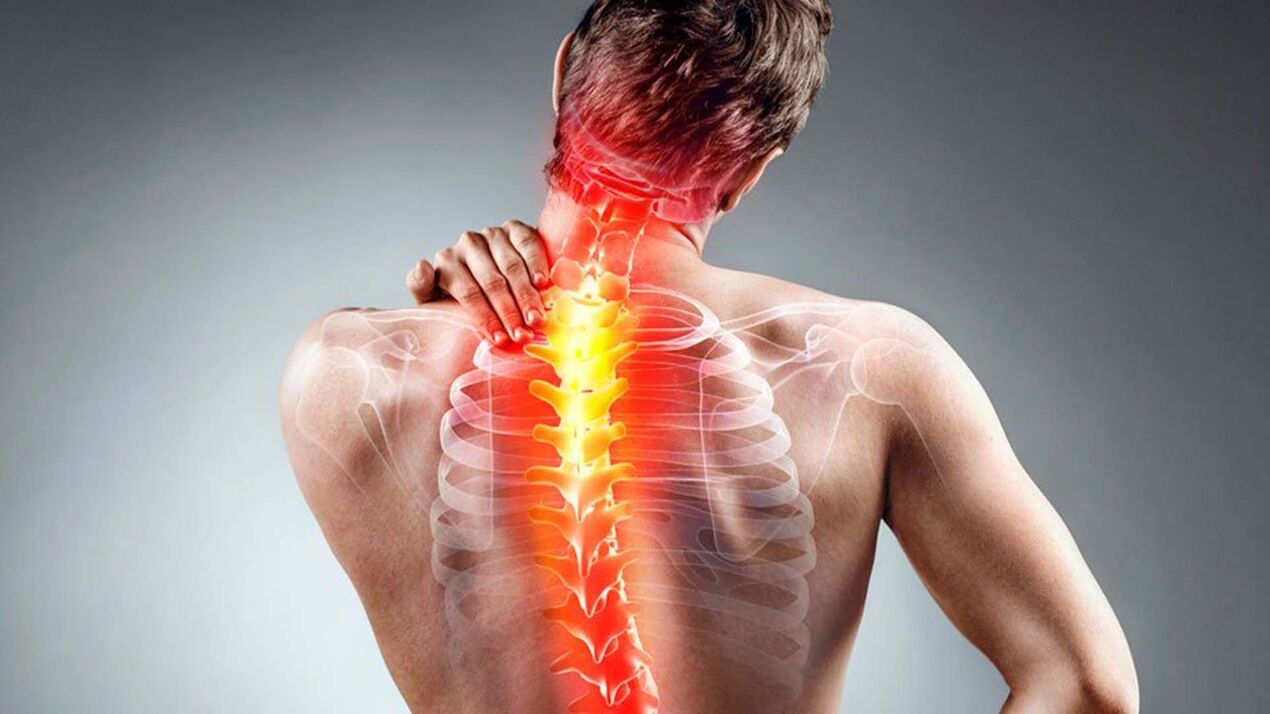 příznaky spinální osteochondrózy